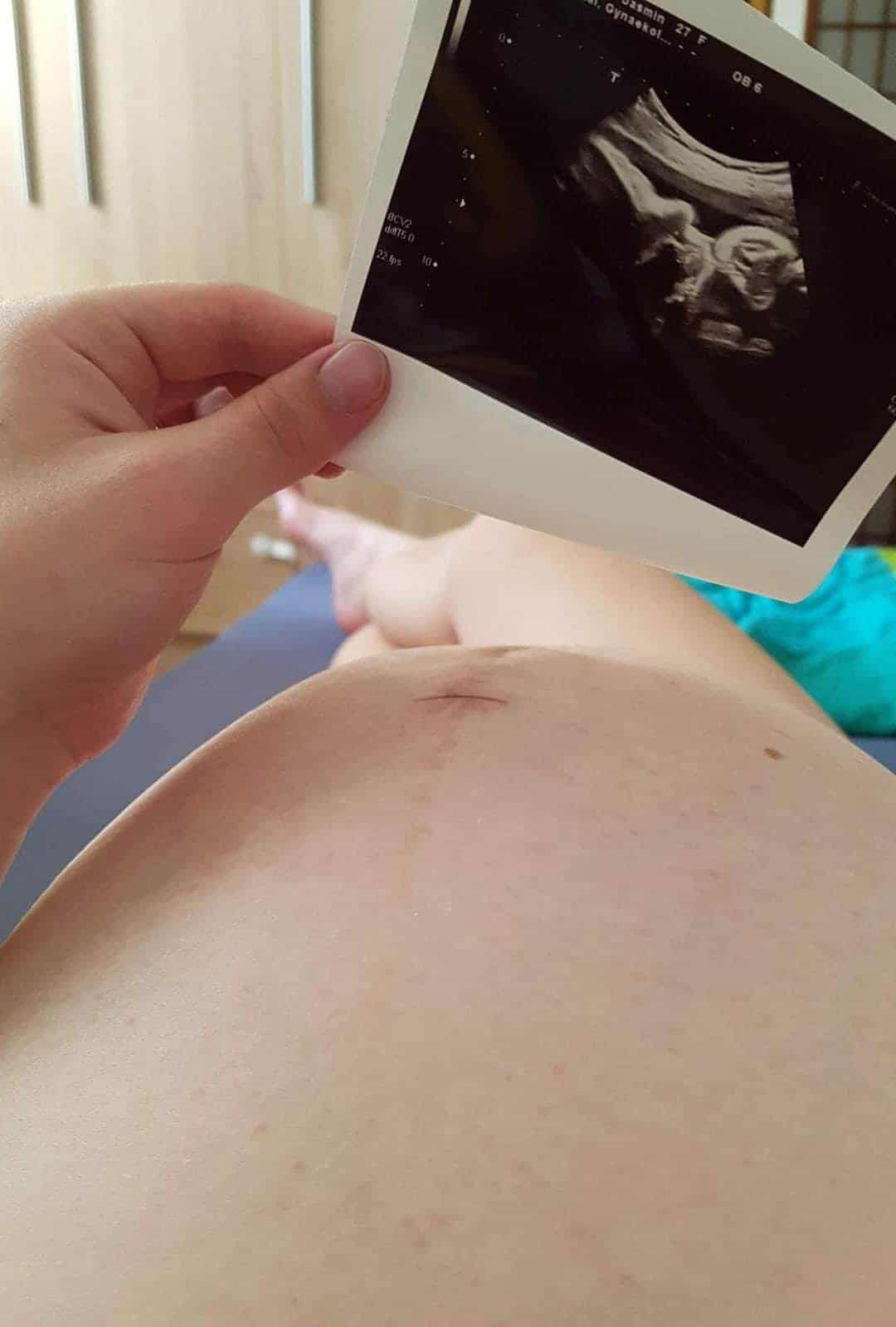 Schatz, meine Fruchtblase ist geplatzt! >> Geburtsbericht Teil 2